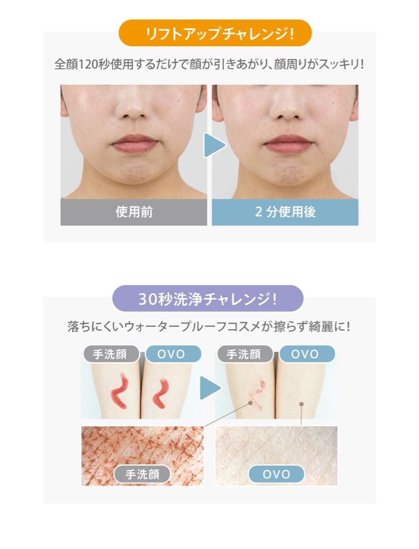 ［新品未使用］ZOGANKIN OVO​ゾーガンキンオーヴォ美顔器